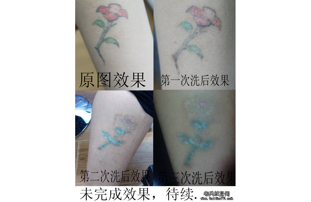 武汉最好的彩色洗纹身店带来一款彩色花卉洗纹身效果对比