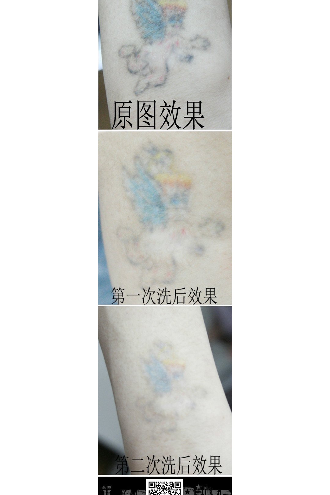 武汉彩色洗纹身效果最好的店带来一组彩色洗纹身效果案例