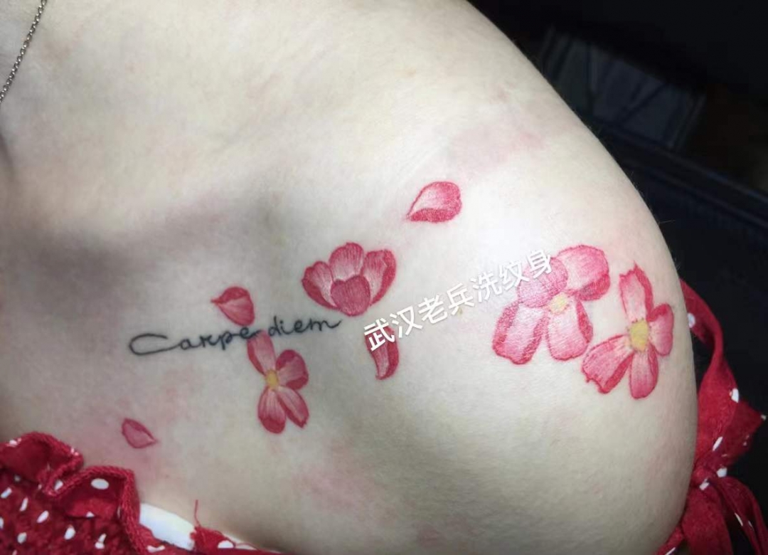 武汉皮秒洗纹身：妹子锁骨红色樱花纹身洗纹身两次后效果